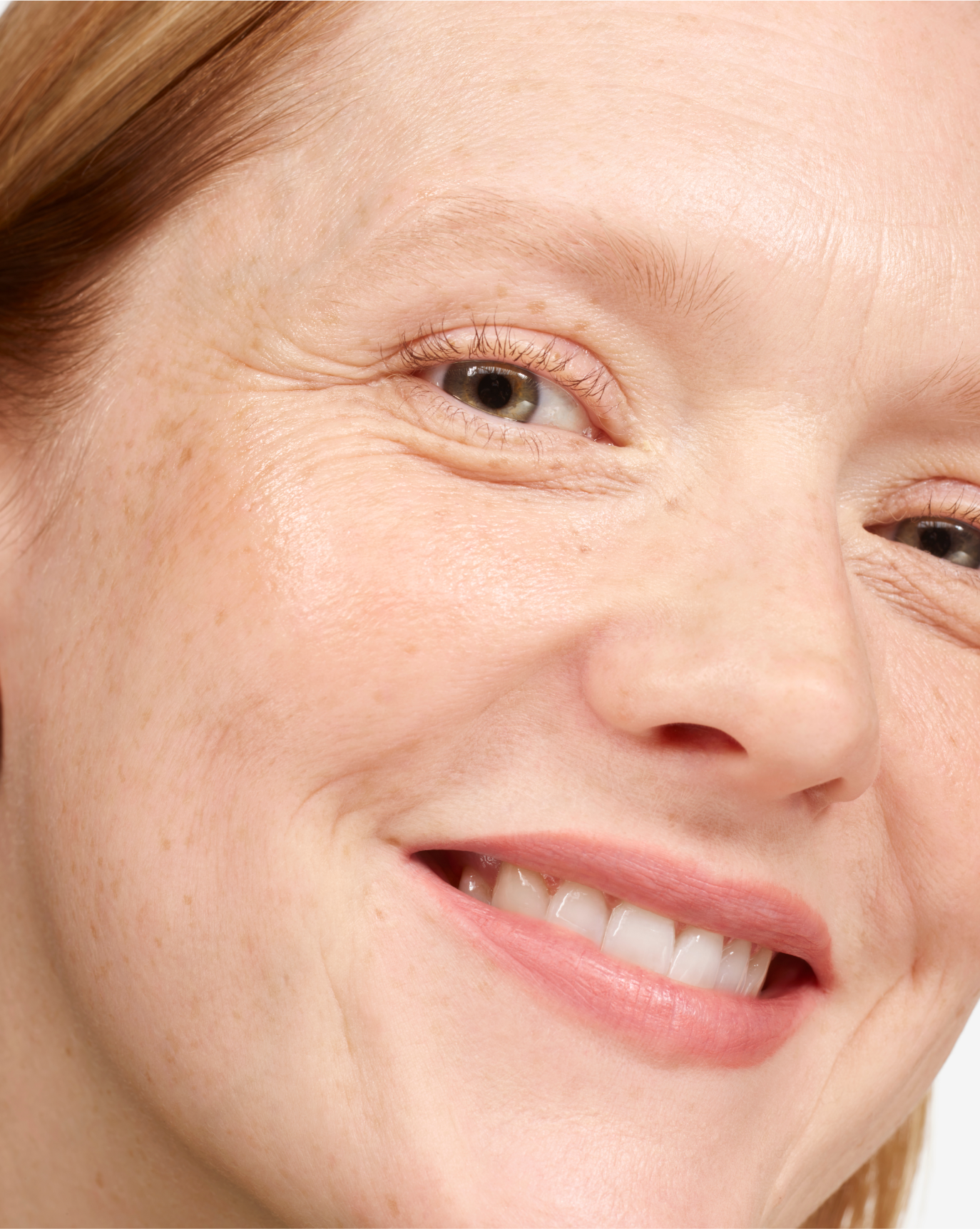 Lip Line - Image 23